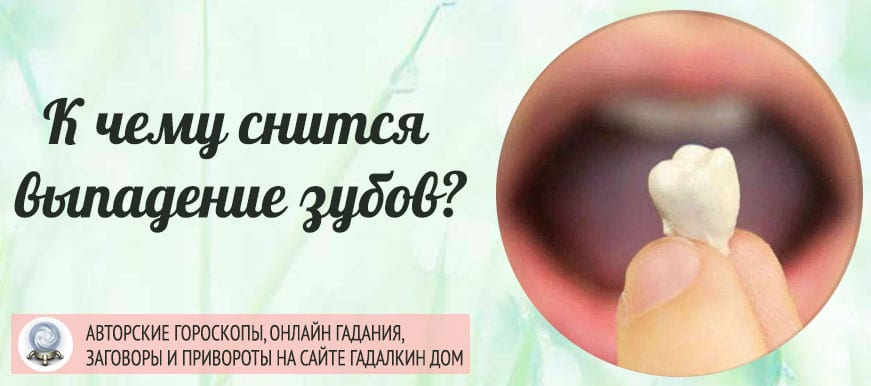 К чему снится выпадение зубов