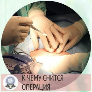 операция на желудке по соннику